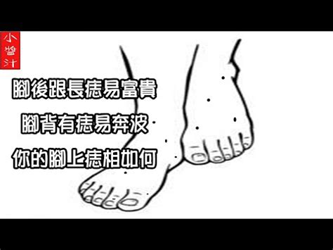 右腳側有痣|非富即貴！5種腳相註定好命 痣長在這裡「天生帝王命」